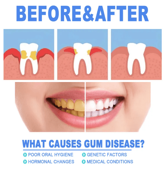 Teeth Repair Gel - The Humanitarians & Robotarians LLC.